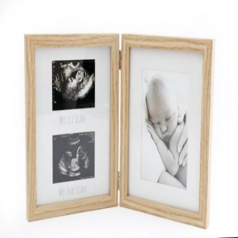 Cadre 2 photos naissance – Qualité & Prix chez Alpha55 – Pour une maison organisée et élégante Format 20 x 20 cm